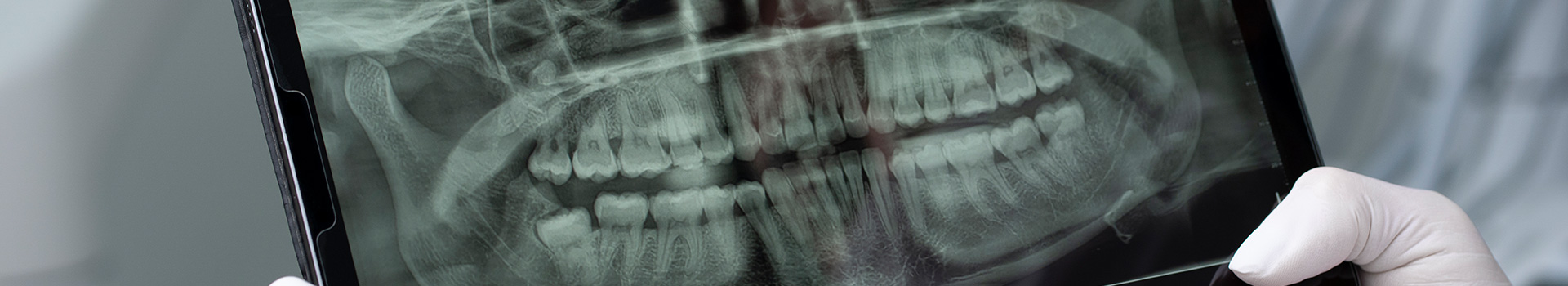 ORAL MEDICINE AND RADIOLOGY